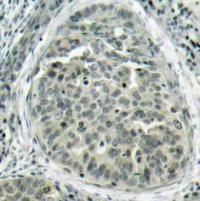 CTNNB1 Antibody