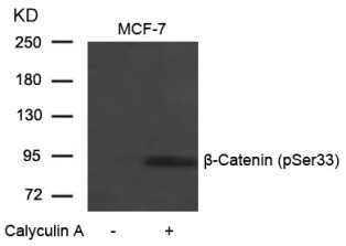 CTNNB1 Antibody
