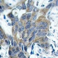 CTNNB1 Antibody