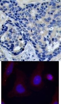 PTK2B Antibody