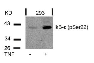 NFKBIE Antibody