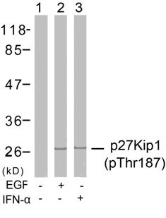 CDKN1B Antibody