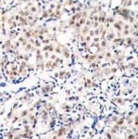 CDKN1B Antibody