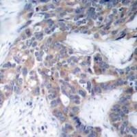MEK1 / MEK2 (phospho Ser217 / Ser221) Antibody