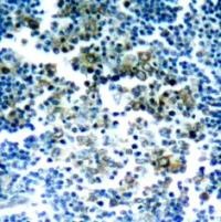 BCR Antibody