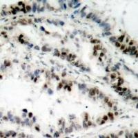 SMC1 (phospho Ser957) Antibody