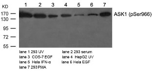MAP3K5 Antibody