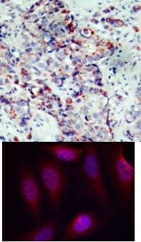 SEK1 / MKK4 (phospho Ser80) Antibody
