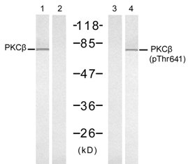 PKCbeta (phospho Thr641) Antibody
