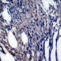NFKBIA Antibody
