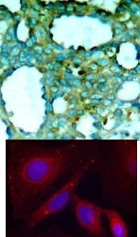 PAK1 (phospho Thr212) Antibody