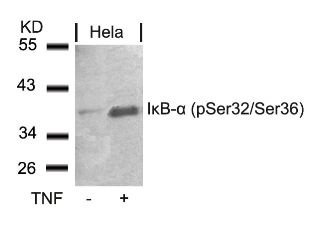 NFKBIA Antibody