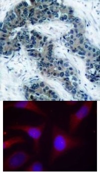 NFKBIA Antibody