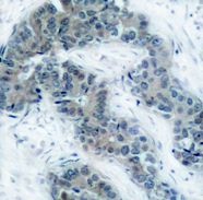 JAK2 (phospho Tyr1007) Antibody