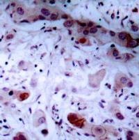 JAK1 Antibody