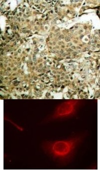 cofilin (phospho Ser3) Antibody