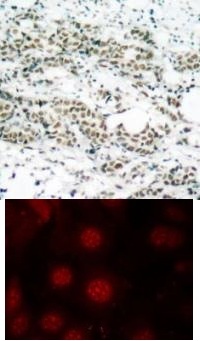 FOXO4 Antibody