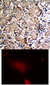 FOXO1 Antibody