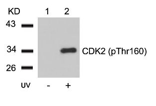CDK2 (phospho Thr160) Antibody