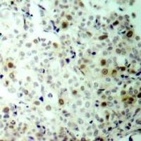 CDK2 (phospho Thr160) Antibody