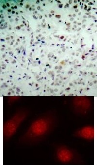 Rb (phospho Ser780) Antibody