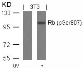 RB1 Antibody