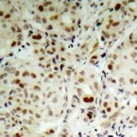RB1 Antibody