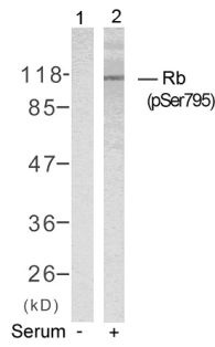 RB1 Antibody