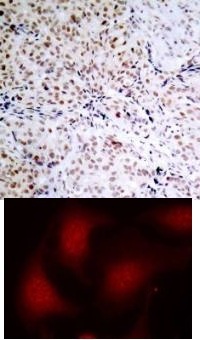 RB1 Antibody