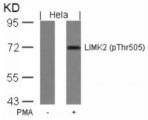 LIMK2 (phospho Thr505) Antibody