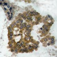 AKT2 Antibody