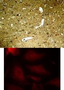 Tau (phospho Ser404) Antibody