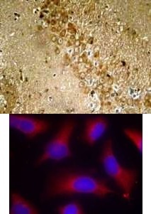 Tau (phospho Ser262) Antibody
