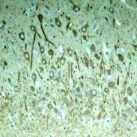 MAPT Antibody