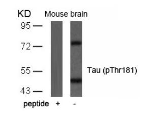 MAPT Antibody