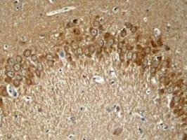 MAPT Antibody