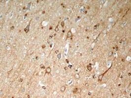 Tau (phospho Ser396) Antibody