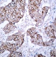 EGFR Antibody
