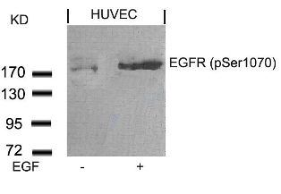 EGFR Antibody