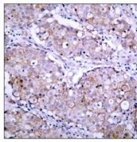 EGFR Antibody