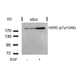 HER2 (phospho Tyr1248) Antibody