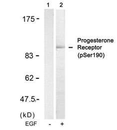 PGR Antibody