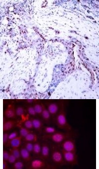 PGR Antibody