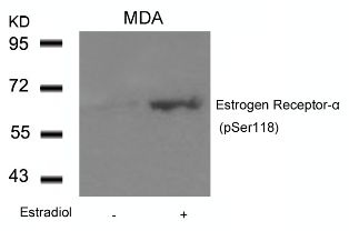 Estrogen Receptor a (phospho Ser118) Antibody