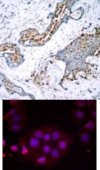Estrogen Receptor a (phospho Ser118) Antibody