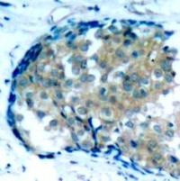 Ezrin (phospho Tyr353) Antibody