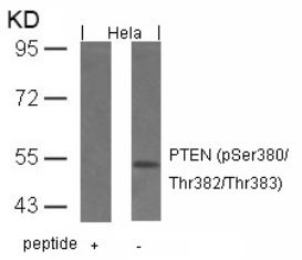 PTEN (phospho Ser380 / Thr382 / Thr383) Antibody