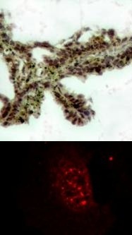 AKT1 Antibody