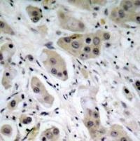 Akt (phospho Ser473) Antibody