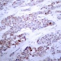 ATF4 (phospho Ser245) Antibody